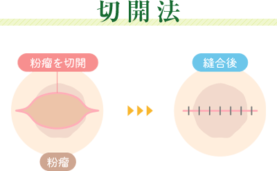 切開法